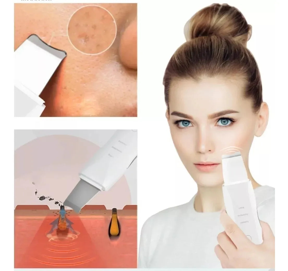 Limpiador Facial Ultrasónico
